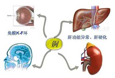 人體草莓视频官网污數據能夠準檢測出但身體中微量元素銅超標會引起疾病發生